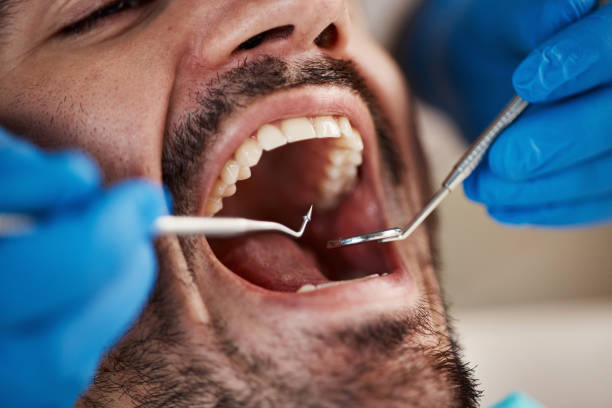 Best Emergency Dentist Near Me  in Travilah, MD