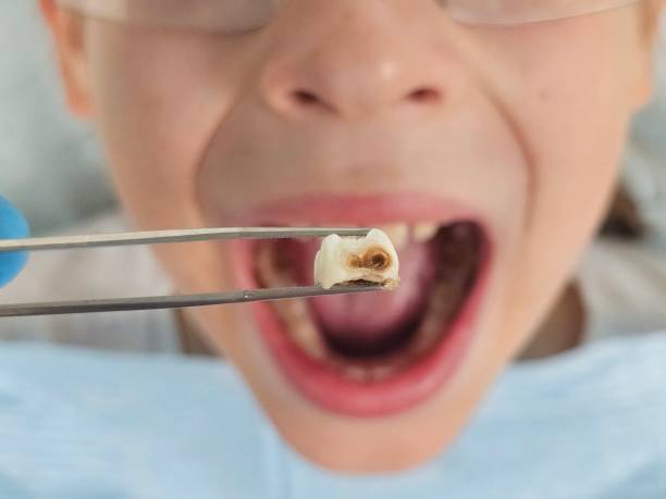 Best Dentist Open Late Near Me  in Travilah, MD